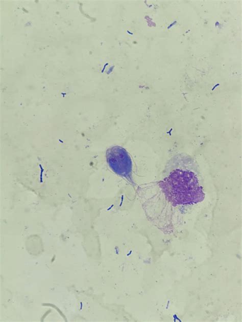 Fecal Wbc Prep With Stain