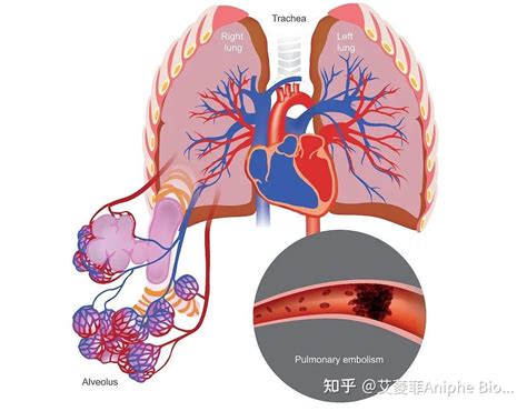 疾病模型一文了解肺动脉高压模型（ph）的各种建立方法！ 知乎