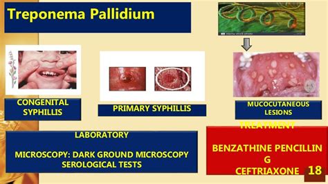 Sexaually Transmitted Infections And Reproductive Tract Infections