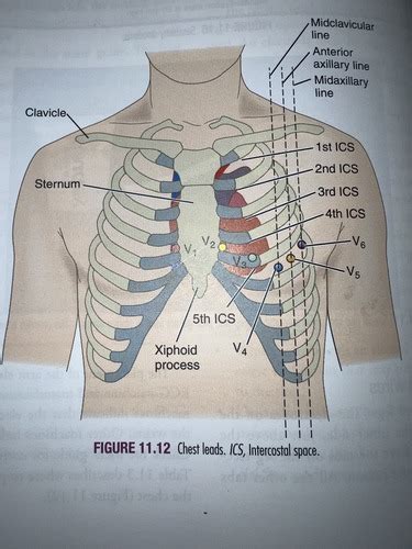 Ekg Placement Flashcards Quizlet