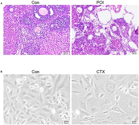 Typical Characteristics Of The Ovary And Granulosa Cells Gcs Of