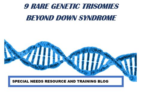 9 Rare Genetic Trisomies Beyond Down Syndrome Trisomy 21 Special Needs Resource And Training