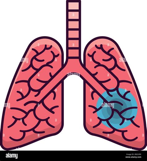 Ilustraci N Del Vector De Los Pulmones Humanos Infectados Aislada