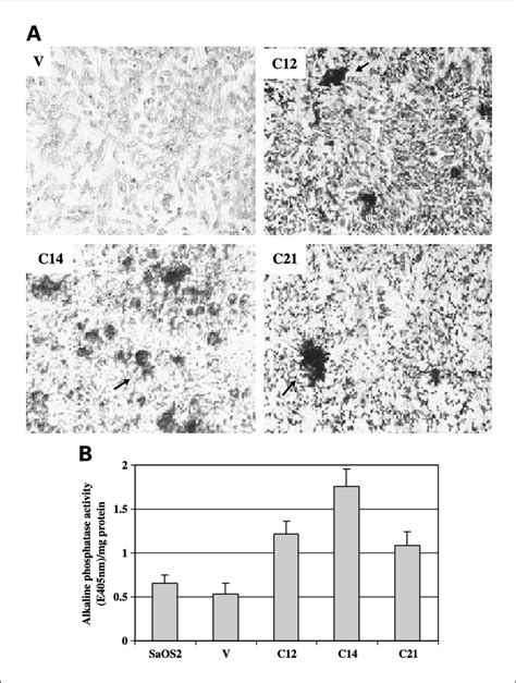 A Von Kossa Staining Of Vector Control V And PSA CDNA Transfected