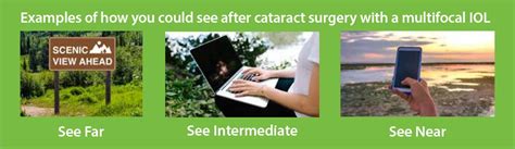 Multifocal IOL in Cataract Surgery | Dominion Eye Care | Manassas VA, Ophthalmologists