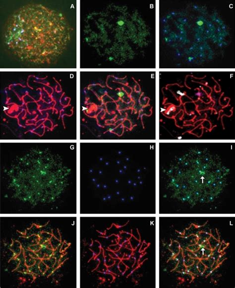 Sumo Is Identified In Human Pachytene Spermatocytes Meiotic