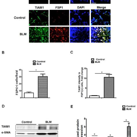 Tiam Expression In Lung Fibroblasts From Control And Blmtreated Mice