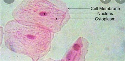 [Solved] Label the cell membrane, cytoplasm and nuclei on this human skin slide | Course Hero