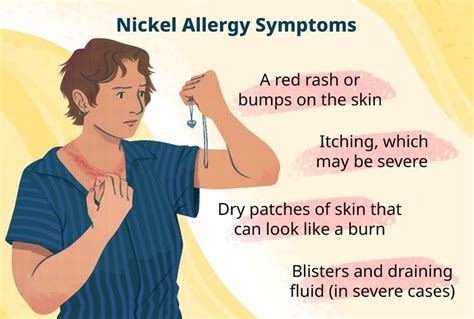 Nickel Allergy: Causes, Symptoms, Treatment, Tests & More