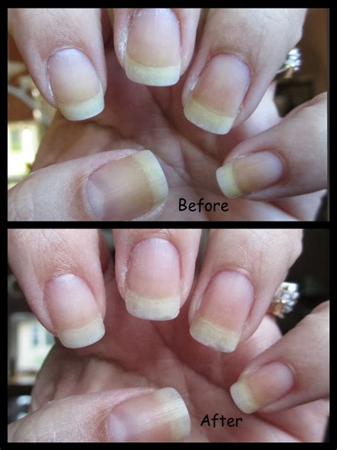 Cha Cha Cakes Nails Nail Whitening Products Bubble White Vs Denture