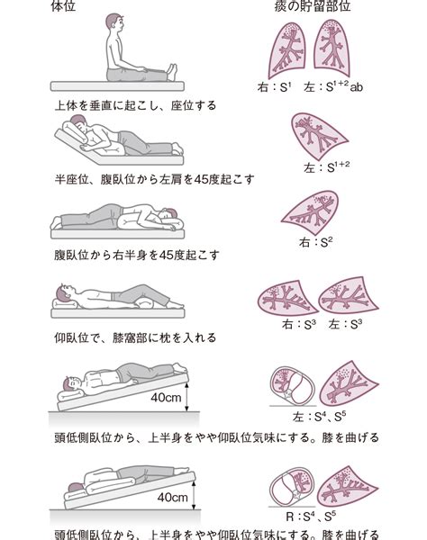 ardsclinical practice guideline uvleg