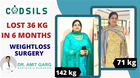 Mini Gastric Bypass In Punjab Best Weight Loss Surgeon In Punjab I