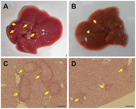 Investigation Of The Roles Of Exosomes In Colorectal Cancer Liver