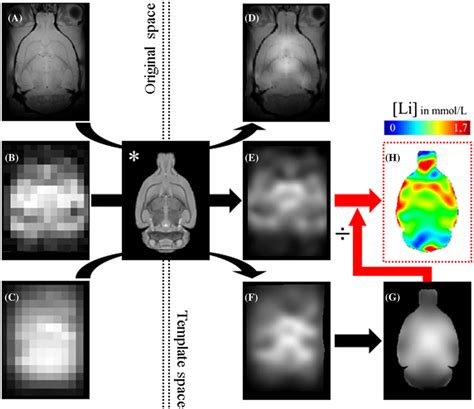 7 Li Magnetic Resonance Imaging MRI Quantification Pipeline Using A