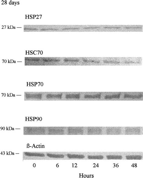 Relative Expressions Of Heat Shock Protein HSP 27 Heat Shock Cognate