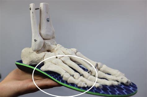 Bone That Sticks Out On Inside Of Foot Online Emergencydentistry