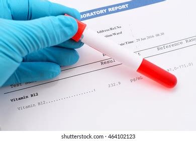 Blood Sample Psa Prostatespecific Antigen Result Stock Photo 291767981