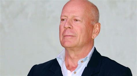 Bruce Willis’ Aphasia Explained Symptoms Of The Star S Condition Uwinhealth