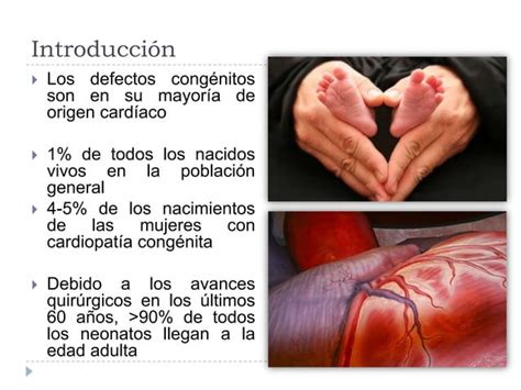 Cardiopatías Congénitas En El Adulto Ppt Descarga Gratuita