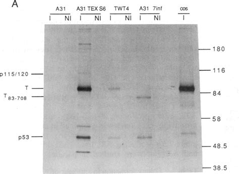 Immunoprecipitation Of 35s Methionine Labeled Extracts Of Various