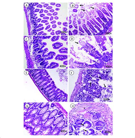 Intestine Histology Necrosis Is Observed In Intestinal Microvilli