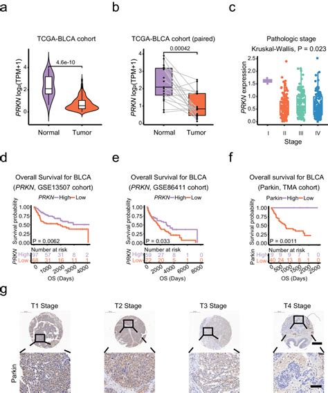 Parkin Inhibits Proliferation And Migration Of Bladder Cancer Via