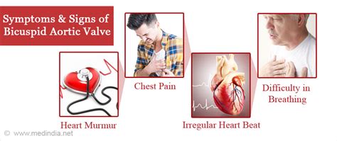 Bicuspid Aortic Valve - Causes, Symptoms, Complications, Diagnosis ...