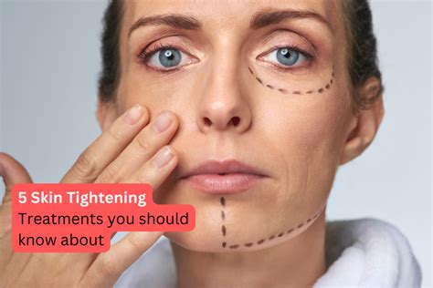 Best Skin Tightening Treatments For Loose Skin