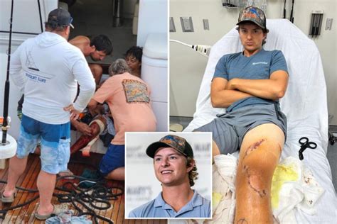 Florida Fisherman Marlin Wakeman Attacked After Falling Into Shark