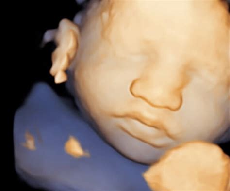 3D Ultrasound Image Gallery | Prenatal Universe Ultrasound