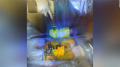 This Tech Uses Augmented Reality To Give Surgeons ‘superpowers’ Neurosurgical Tv