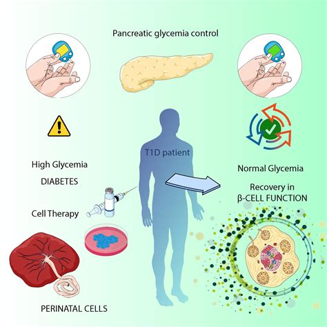 Ijms Free Full Text Perinatal Stem Cell Therapy To Treat Type 1 Diabetes Mellitus A Never