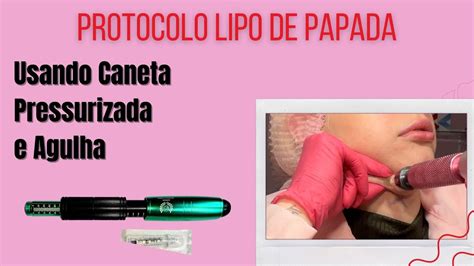 Protocolo Lipo De Papada Caneta Pressurizada E Agulha Youtube