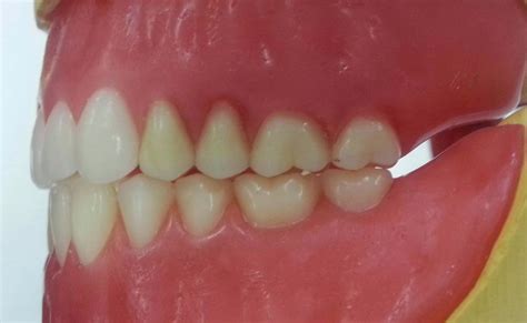 The Incisor Teeth And Its Functions Lets Talk Teeth