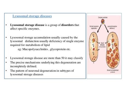 Mucopolysaccharidosis