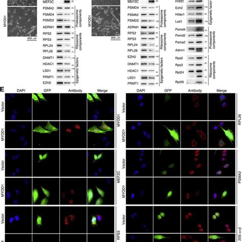Effect Of Myod1 Induced Differentiation On The Expression Of Ribosome