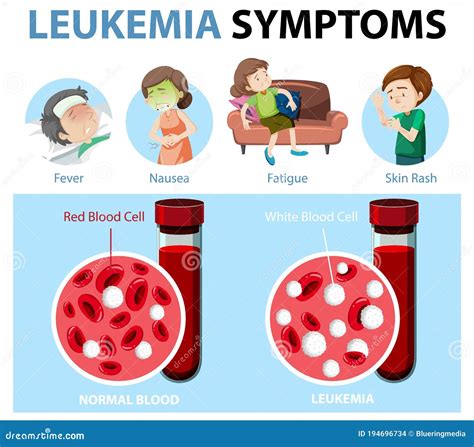 Leukemia Symptoms Cartoon Style Infographic Stock Vector Illustration