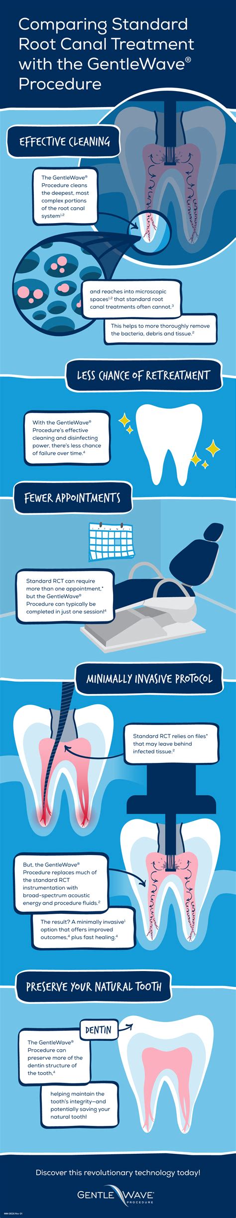 An Innovative Root Canal Alternative | The GentleWave® Procedure