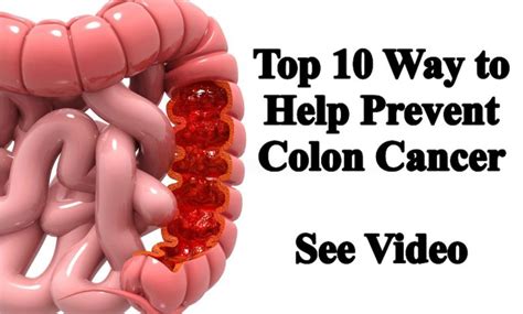 Top Ways To Help Prevent Colon Cancer Dr Paul Haider Award