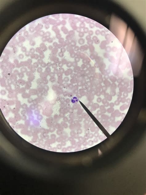 Neutrophil Diagram Quizlet