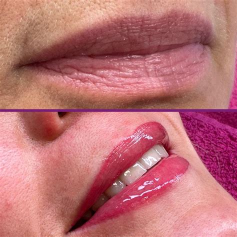 Permanent Make Up Lippen Lippenkontur Mit Voll Oder Anschattierung