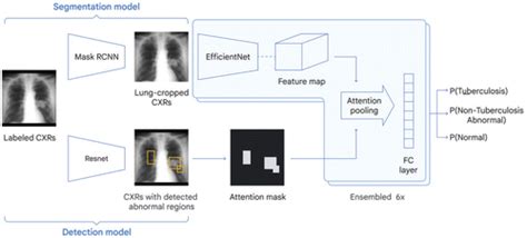 Deep Learning Detection Of Active Pulmonary Tuberculosis At Chest