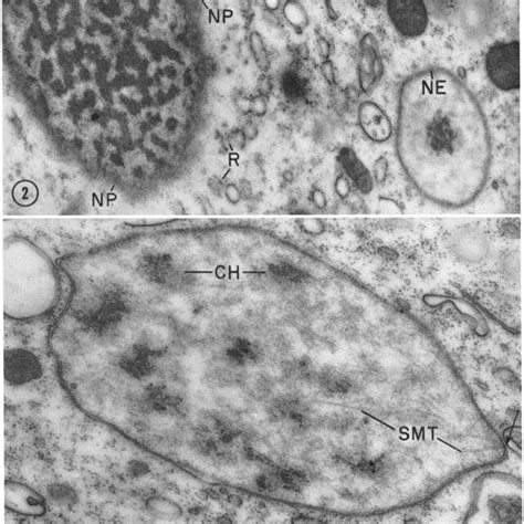 Figune 12 A Slightly Later Stage Of Nuclear Envelope Formation Than Download Scientific Diagram