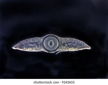 Planaria Cross Section Anterior Level Pharynx Stock Photo 9243655 ...