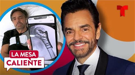 Eugenio Derbez Por Fin Aparece Y Da Preocupantes Detalles De Su Accidente La Mesa Caliente