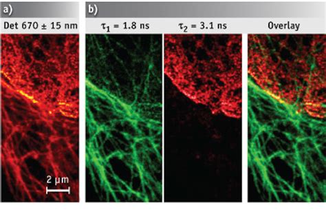 Microscopy Live Cell Imaging Cell Biology First Sted Imaging Of Live Cells In Two Colors