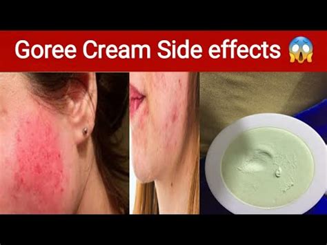 Goree Cream Side Effects Youtube