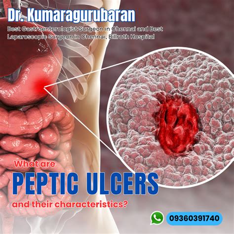 Understanding Dyspepsia Causes Symptoms And Treatment By Drkumaragurubaran Apr 2024 Medium