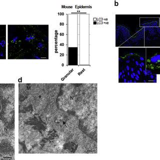 Nucleophagy In Terminal Differentiated Layers Of Mouse And Human