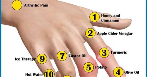 Easy Gout Treatment and Prevention Tips: Safe Gout Prevention Tips - Don't Delay Gout Treatment